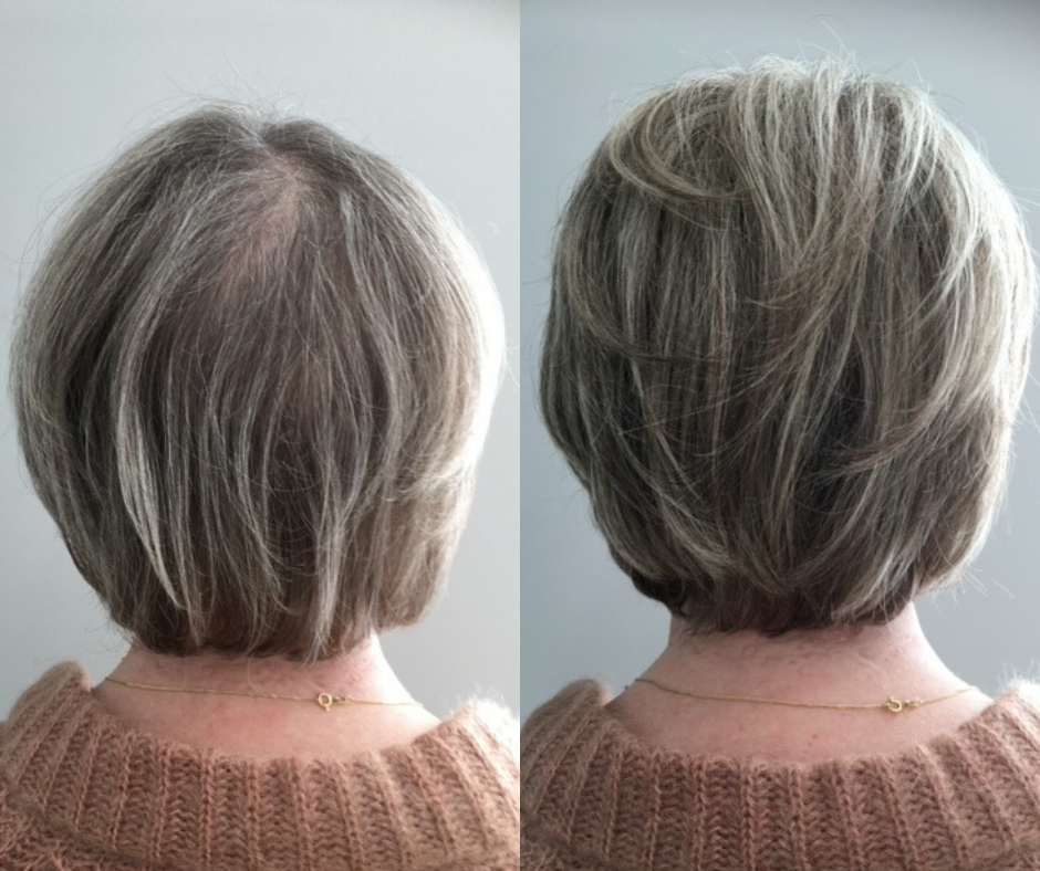 Voor en na foto dun haar